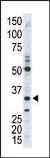 Anti-CDC2 (CDK1) (C-term) Antibody