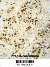 Anti-CDK1 (T14) Antibody