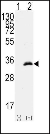 Anti-CDK1 (T14) Antibody
