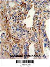Anti-CDK4 (C-term) Antibody