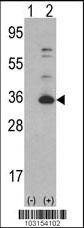 Anti-CDK4 (C-term) Antibody