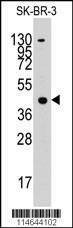 Anti-ACAT1 (C-term) Antibody