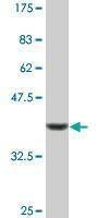Anti-INPP1 Antibody
