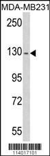Anti-RASGRF1 (S929) Antibody