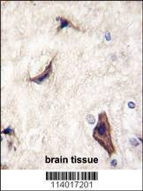 Anti-RASGRF1 (S929) Antibody