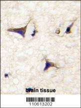 Anti-DAAM2 (N-term) Antibody