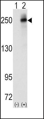Anti-ALK (Center) Antibody