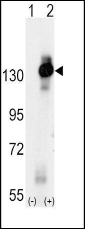Anti-MCSF Receptor (CSF1R) (C-term) Antibody