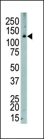 Anti-MCSF Receptor (CSF1R) (C-term) Antibody
