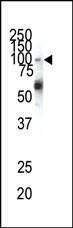 Anti-EphA1 (N-term) Antibody