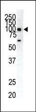 Anti-EphA1 (C-term) Antibody