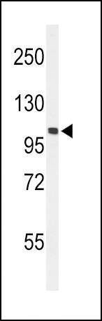 Anti-EphA2 (N-term) Antibody