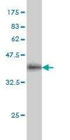 Anti-IQGAP2 Antibody
