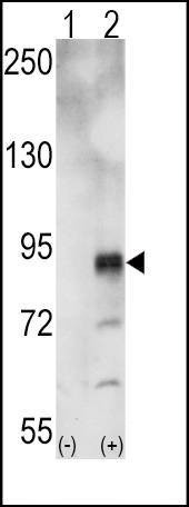 Anti-EphA5 Antibody