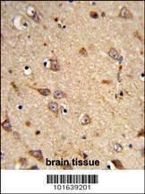 Anti-EphA7 (N-term) Antibody