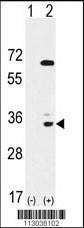 Anti-EPHA10 (N-term) Antibody