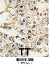 Anti-EPHA10 (N-term) Antibody