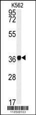 Anti-NCF4 (C-term) Antibody