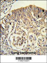 Anti-PLTP (C-term) Antibody