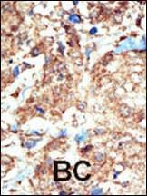 Anti-EphB1 (C-term) Antibody