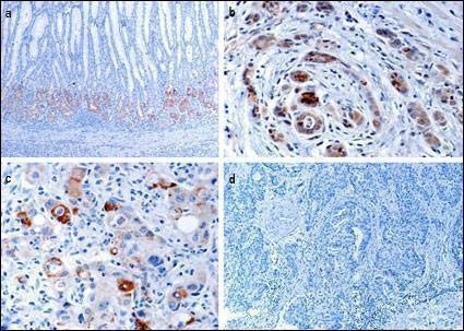 Anti-EphB1 (C-term) Antibody