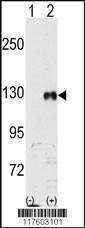Anti-EphB1 Antibody