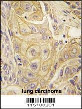 Anti-EphB2 Antibody