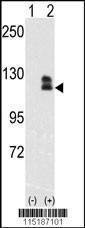 Anti-EphB2 Antibody