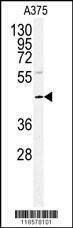Anti-POLDIP2 (Center) Antibody