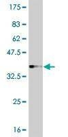 Anti-IRAK3 Antibody