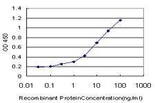 Anti-IRAK3 Antibody