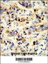 Anti-EGFR Antibody