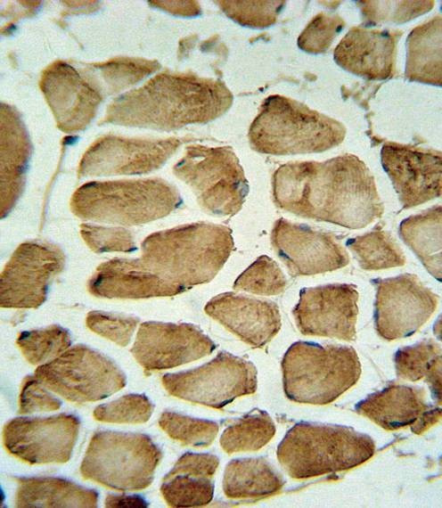 Anti-CA3 (Center) Antibody