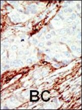 Anti-FGFR1 (N-term) Antibody