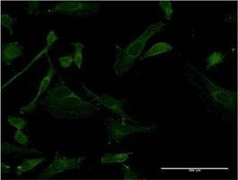 Anti-IRAK4 Antibody