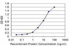 Anti-IRAK4 Antibody