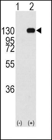 Anti-FGFR1 (Y463) Antibody