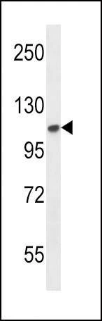 Anti-FGFR2 (N-term) Antibody