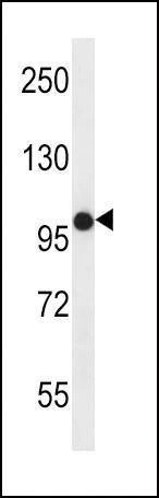 Anti-FGFR2 (N-term) Antibody