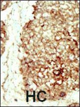 Anti-FGFR2 (C-term) Antibody