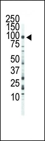 Anti-FGFR3 (C-term) Antibody