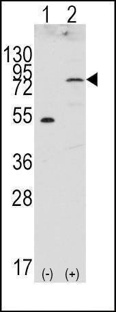 Anti-FGFR4 Antibody