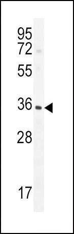 Anti-IGFBP3 (S183) Antibody