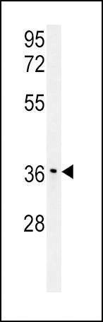 Anti-IGFBP3 (S183) Antibody