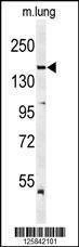 Anti-KDR (Y1175) Antibody