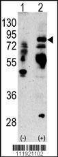 Anti-Lactoferrin (LTF) (Center) Antibody