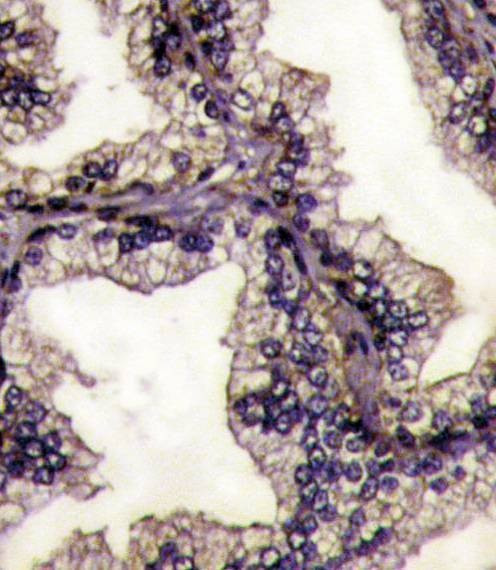 Anti-Lactoferrin (LTF) (Center) Antibody