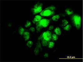 Anti-IRF5 Antibody