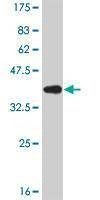Anti-IRF5 Antibody