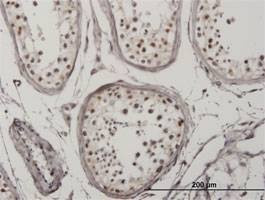 Anti-IRF5 Antibody